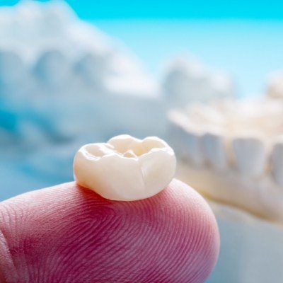 Close up of a dental crown on a finger