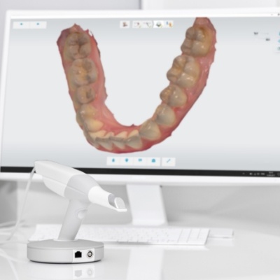 Digital impression of row of teeth on computer screen