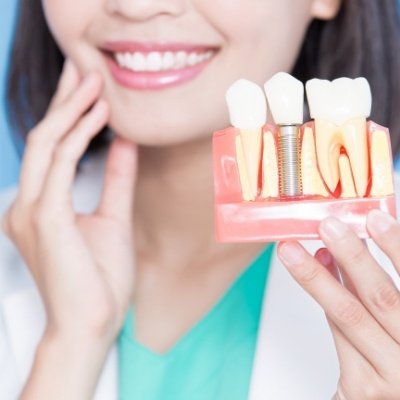 Dentist touching her face while holding a dental implant model