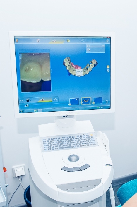 Digital images of teeth on screen using advanced dental technology in Millis