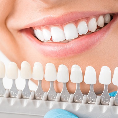 Dental shade guide next to woman’s teeth