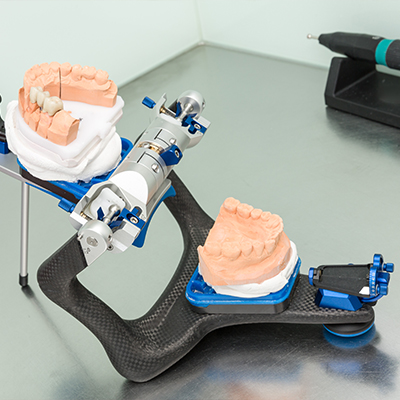 Model of the upper and lower arches of teeth