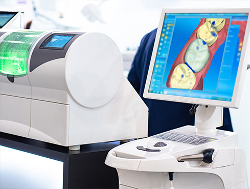 Digital model of a patient's teeth on computer screen in dental office